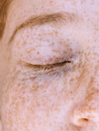 Targeted Dark Spot Care, 1% Kojic Acid Serum