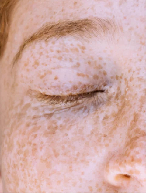 Targeted Dark Spot Care, 1% Kojic Acid Serum
